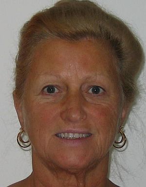 Middle aged lady before permanent makeup