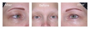 Hairstroke Eyebrows Before After